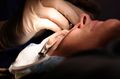 Lasik Surgery